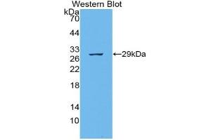 Detection of Recombinant PCX, Mouse using Polyclonal Antibody to Podocalyxin (PODXL) (PODXL 抗体  (AA 171-404))