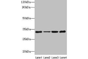 Western blot All lanes: PDCD1 antibody at 6 μg/mL Lane 1: 293T whole cell lysate Lane 2: Hela whole cell lysate Lane 3: K562 whole cell lysate Lane 4: Mouse stomach tissue Secondary Goat polyclonal to rabbit IgG at 1/10000 dilution Predicted band size: 32 kDa Observed band size: 32 kDa (PD-1 抗体  (AA 21-170))
