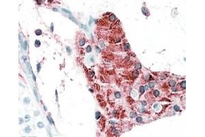 IHC testing of FFPE human testis with TIAM2 antibody at 5ug/ml. (TIAM2 抗体)