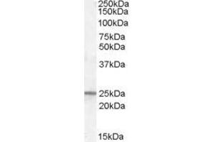 Western Blotting (WB) image for anti-Progesterone Receptor Membrane Component 1 (PGRMC1) antibody (ABIN5873921) (PGRMC1 抗体)