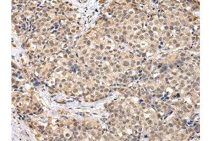 Immunohistochemistry (IHC) image for anti-Transducin (Beta)-Like 1X-Linked (TBL1X) antibody (ABIN5961942) (TBL1X 抗体)