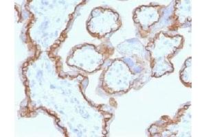 Immunohistochemistry (Formalin-fixed Paraffin-embedded Sections) (IHC (fp)) image for anti-Cadherin 1, Type 1, E-Cadherin (Epithelial) (CDH1) antibody (ABIN4949627)