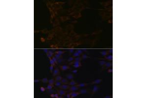 Immunofluorescence analysis of NIH-3T3 cells using HSP Rabbit mAb (ABIN1679173, ABIN3015940, ABIN3015941 and ABIN7101465) at dilution of 1:100 (40x lens). (HSPA14 抗体)