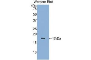 Western Blotting (WB) image for anti-Cathepsin D (CTSD) (AA 23-161) antibody (ABIN1174453) (Cathepsin D 抗体  (AA 23-161))
