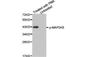 Western Blotting (WB) image for anti-Mitogen-Activated Protein Kinase Kinase 6 (MAP2K6) (pSer207) antibody (ABIN1870361) (MAP2K6 抗体  (pSer207))