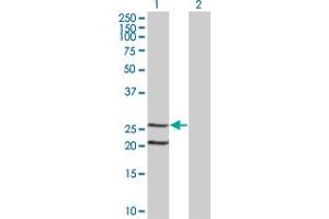 Western Blot analysis of IL6 expression in transfected 293T cell line by IL6 monoclonal antibody (M07), clone 1G8. (IL-6 抗体  (AA 29-212))