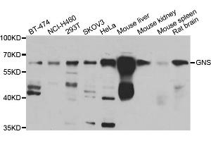 Western blot analysis of extracts of various cell lines, using GNS antibody (ABIN5975568) at 1/1000 dilution. (GNS 抗体)