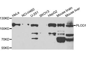 Western blot analysis of extracts of various cell lines, using PLOD1 antibody (ABIN5975225) at 1/1000 dilution. (PLOD1 抗体)