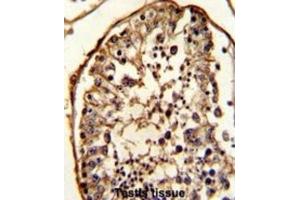 Immunohistochemistry (IHC) image for anti-Tubulin, beta (TUBB) antibody (ABIN5014943) (TUBB 抗体)