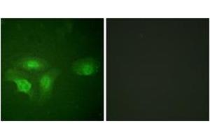 Immunofluorescence analysis of HepG2 cells, using HDAC6 (Phospho-Ser22) Antibody. (HDAC6 抗体  (pSer22))