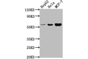 Western Blot Positive WB detected in: HepG2 whole cell lysate, Hela whole cell lysate, MCF-7 whole cell lysate All lanes: PRAMEF18 antibody at 1:2000 Secondary Goat polyclonal to rabbit IgG at 1/50000 dilution Predicted band size: 56 kDa Observed band size: 56 kDa (PRAMEF18 抗体  (AA 1-257))