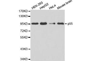 Western blot analysis of extracts of various cell lines, using NBN antibody (ABIN5970297). (Nibrin 抗体)