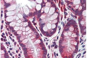 Human Small Intestine: Formalin-Fixed, Paraffin-Embedded (FFPE) (Caspase 8 抗体)