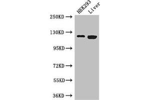 Western Blot Positive WB detected in: HEK293 whole cell lysate, Mouse liver tissue All lanes: PDGFRA antibody at 3 μg/mL Secondary Goat polyclonal to rabbit IgG at 1/50000 dilution Predicted band size: 123, 25, 83 kDa Observed band size: 123 kDa (PDGFRA 抗体  (AA 30-198))