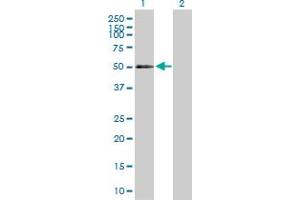 Western Blot analysis of CD177 expression in transfected 293T cell line by CD177 MaxPab polyclonal antibody. (CD177 抗体  (AA 1-437))