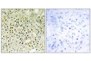 Immunohistochemistry (IHC) image for anti-Lectin, Galactoside-Binding, Soluble, 8 (LGALS8) (Internal Region) antibody (ABIN1850470) (LGALS8 抗体  (Internal Region))