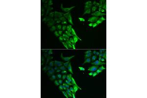 Immunofluorescence analysis of A549 cells using HABP2 antibody. (HABP2 抗体)