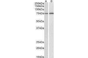 ABIN4902600 (0. (CYP2B6 抗体)