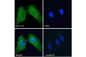 Immunofluorescence (IF) image for anti-Peripheral-Type Benzodiazepine Receptor (TSPO) (C-Term) antibody (ABIN570960)