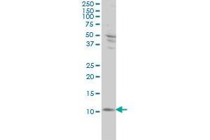 Western Blotting (WB) image for anti-S100 Calcium Binding Protein A4 (S100A4) (AA 1-101) antibody (ABIN562767)