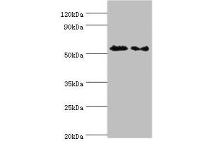 Western blot All lanes: ATG4C antibody at 9 μg/mL Lane 1: Mouse lung tissue Lane 2: HepG2 whole cell lysate Secondary Goat polyclonal to rabbit IgG at 1/10000 dilution Predicted band size: 52 kDa Observed band size: 52 kDa (ATG4C 抗体  (AA 259-458))
