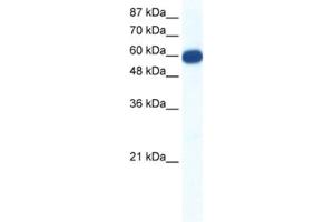Western Blotting (WB) image for anti-Solute Carrier Family 18 (Vesicular Monoamine Transporter), Member 1 (SLC18A1) antibody (ABIN2461184) (SLC18A1 抗体)