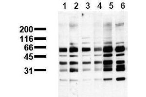 Western Blotting (WB) image for anti-Phosphoserine antibody (ABIN126866) (Phosphoserine 抗体)