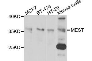 Western blot analysis of extracts of various cells, using MEST antibody. (MEST 抗体)