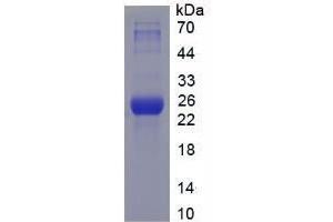 SDS-PAGE analysis of Mouse HSPA5 Protein. (GRP78 蛋白)