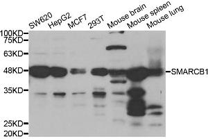 Western blot analysis of extracts of various cell lines, using SMARCB1 antibody (ABIN5973389) at 1/1000 dilution. (SMARCB1 抗体)
