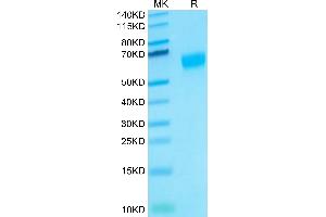 SDS-PAGE (SDS) image for Interleukin 18 Receptor Accessory Protein (IL18RAP) protein (His tag) (ABIN7274972)