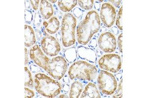 Immunohistochemistry of paraffin-embedded rat kidney using TST Rabbit pAb  at dilution of 1:200 (40x lens). (TST 抗体  (AA 1-297))