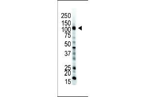 The anti-UBE1 Pab (ABIN388844 and ABIN2839150) is used in Western blot to detect UBE1 in HL-60 cell lysate. (E1 Ubiquitin (AA 1026-1058), (C-Term) 抗体)