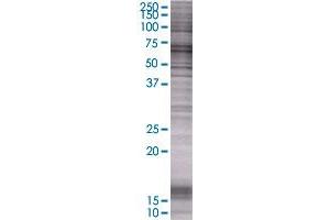 HDAC1 transfected lysate. (HDAC1 293T Cell Transient Overexpression Lysate(Denatured))