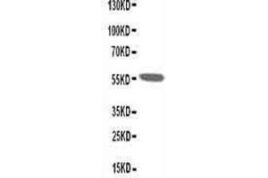 Anti-Nicotinic Acetylcholine Receptor alpha 1 antibody, Western blotting WB: Rat Skeletal Muscle Tissue Lysate (CHRNA1 抗体  (N-Term))