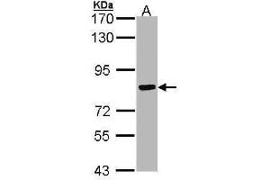 Western Blotting (WB) image for anti-Cortactin (CTTN) (N-Term) antibody (ABIN2854674)