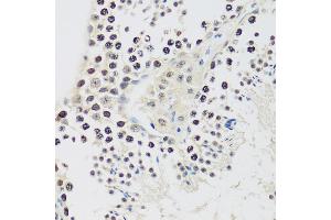 Immunohistochemistry of paraffin-embedded mouse testis using Cyclin E2 antibody (ABIN1679046, ABIN3018761, ABIN3018762 and ABIN6220571) at dilution of 1:100 (40x lens). (Cyclin E2 抗体  (C-Term))