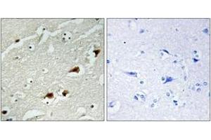 Immunohistochemistry analysis of paraffin-embedded human brain tissue, using NF-kappaB p65 (Ab-529) Antibody. (NF-kB p65 抗体  (AA 496-545))