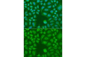 Immunofluorescence analysis of A549 cells using AES antibody. (AES 抗体)