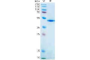 IL-21 Protein (AA 30-162) (Fc Tag)