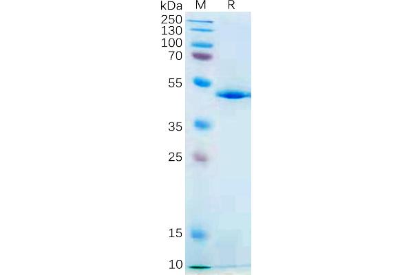 IL-21 Protein (AA 30-162) (Fc Tag)