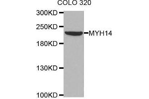Western blot analysis of extracts of COLO320 cell line, using MYH14 antibody. (Myosin 抗体)