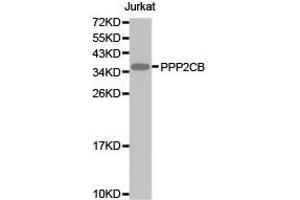 Western Blotting (WB) image for anti-Protein Phosphatase 2, Catalytic Subunit, beta Isozyme (PPP2CB) antibody (ABIN1874224) (PPP2CB 抗体)