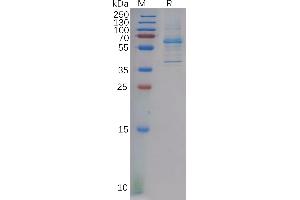 Human Protein, hFc Tag on SDS-PAGE under reducing condition. (DKK2 Protein (AA 34-259) (Fc Tag))
