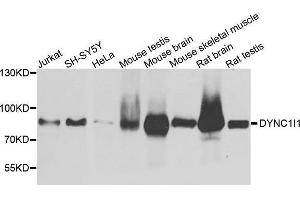 Western Blotting (WB) image for anti-Dynein, Cytoplasmic 1, Intermediate Chain 1 (DYNC1I1) (AA 1-220) antibody (ABIN6220387) (DYNC1I1 抗体  (AA 1-220))