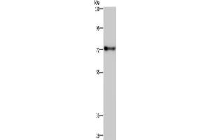 Western Blotting (WB) image for anti-Zinc Finger Protein 278 (ZNF278) antibody (ABIN2433541) (PATZ1 抗体)