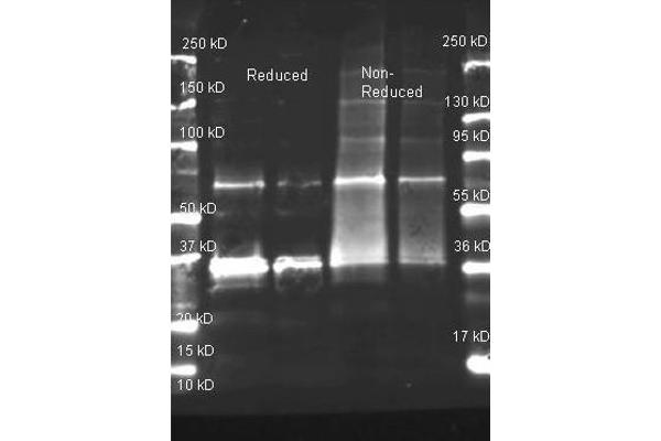 Urate Oxidase 抗体