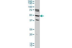 FOXA2 monoclonal antibody (M04A), clone 7G10 Western Blot analysis of FOXA2 expression in HeLa . (FOXA2 抗体  (AA 363-457))
