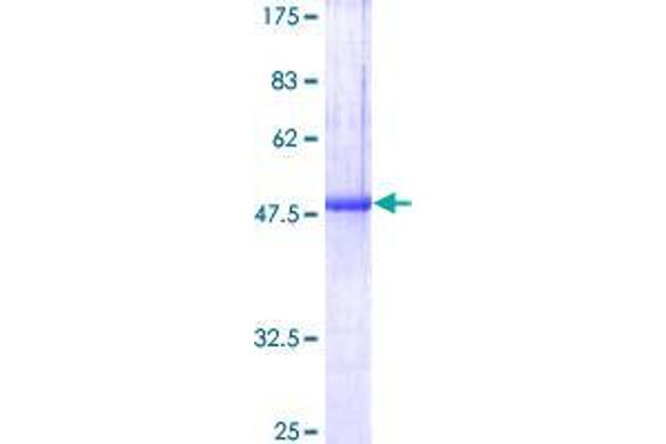 SOSTDC1 Protein (AA 1-206) (GST tag)