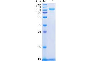 Human Protein, His Tag on SDS-PAGE under reducing condition. (ERBB3 Protein (AA 20-643) (His tag))